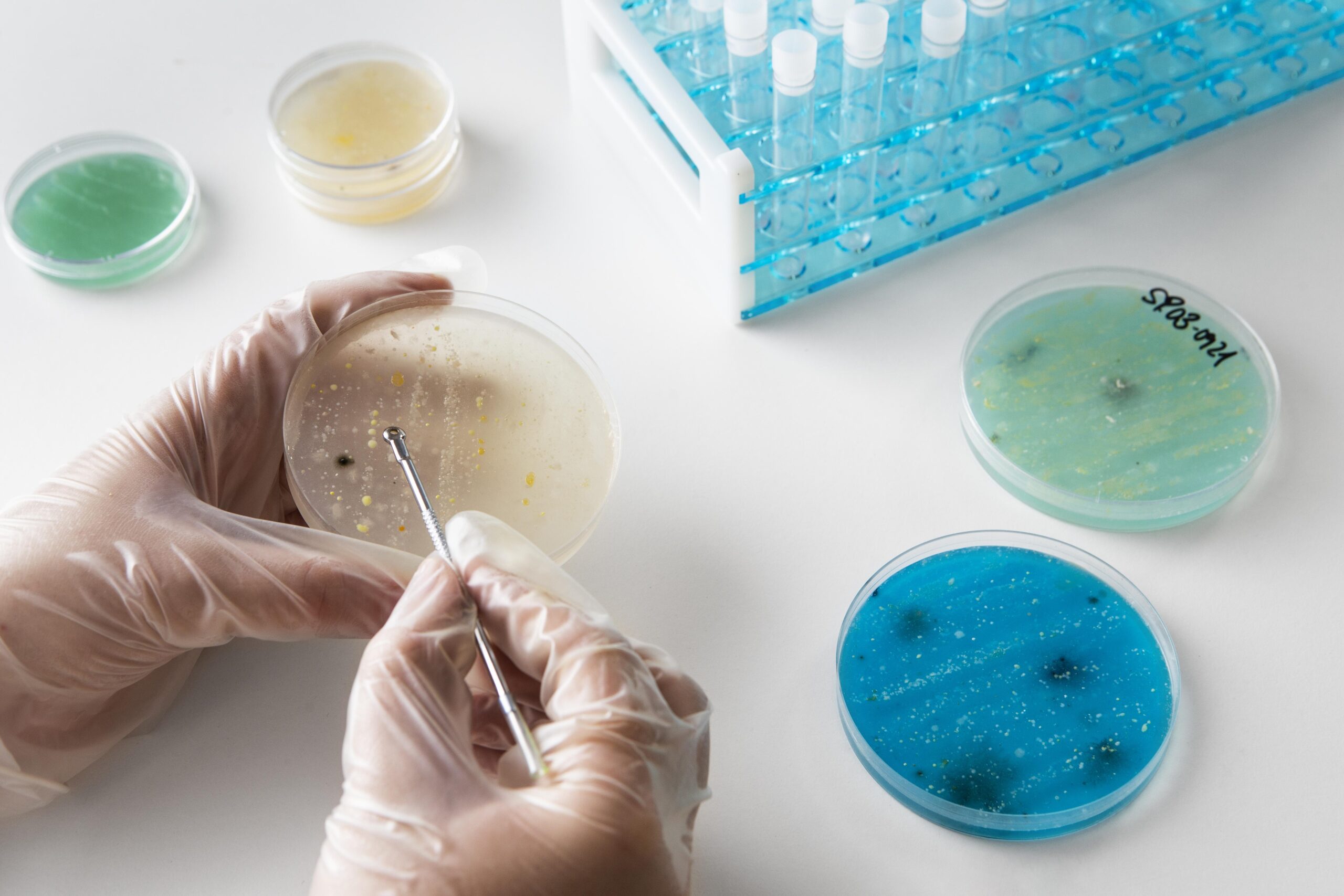 Microba on Agar Plate
